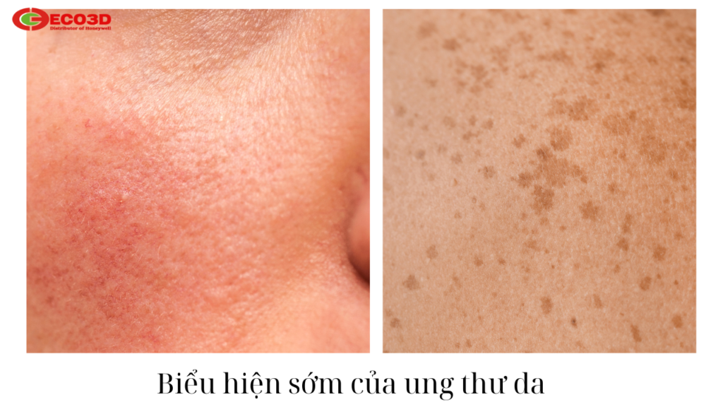 Tia UV từ hàn điện – Mối nguy hiểm tiềm ẩn